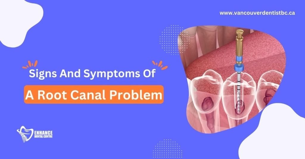 Signs And Symptoms Of A Root Canal Problem