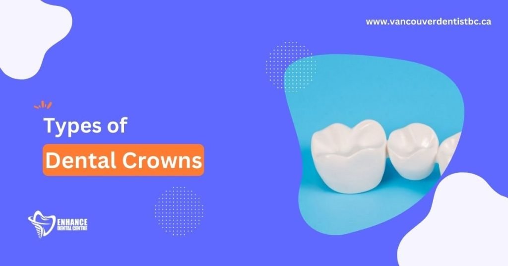 What are the Different Types of Dental Crowns?
