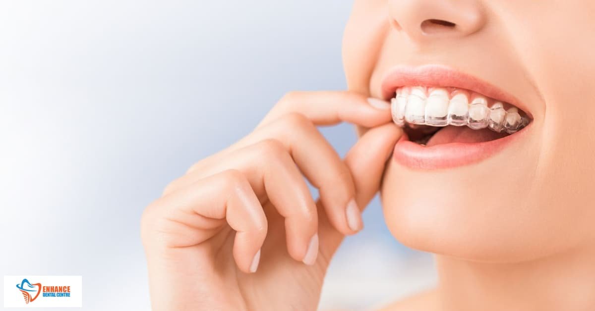 A woman wearing an Invisalign