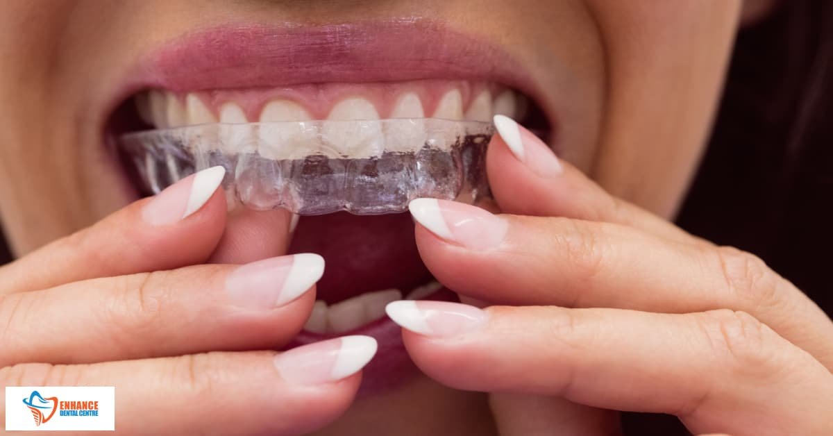 When is Too Late for Gum Grafting?