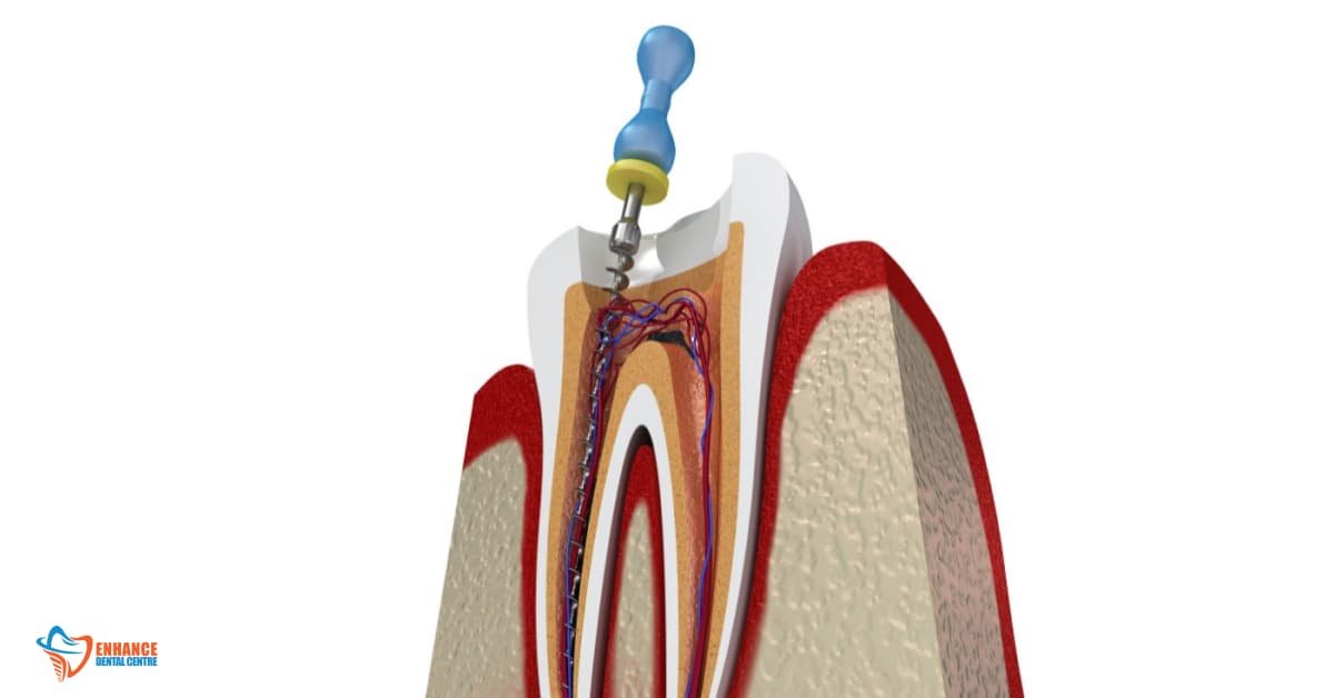 The step-by-step process of treatment