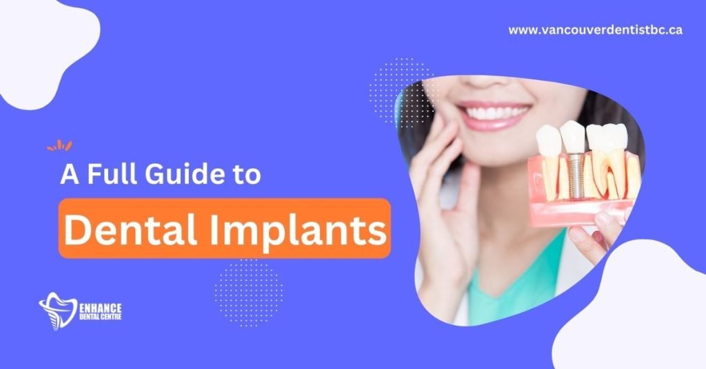 A Full Guide to Dental Implants + Before & After Photos
