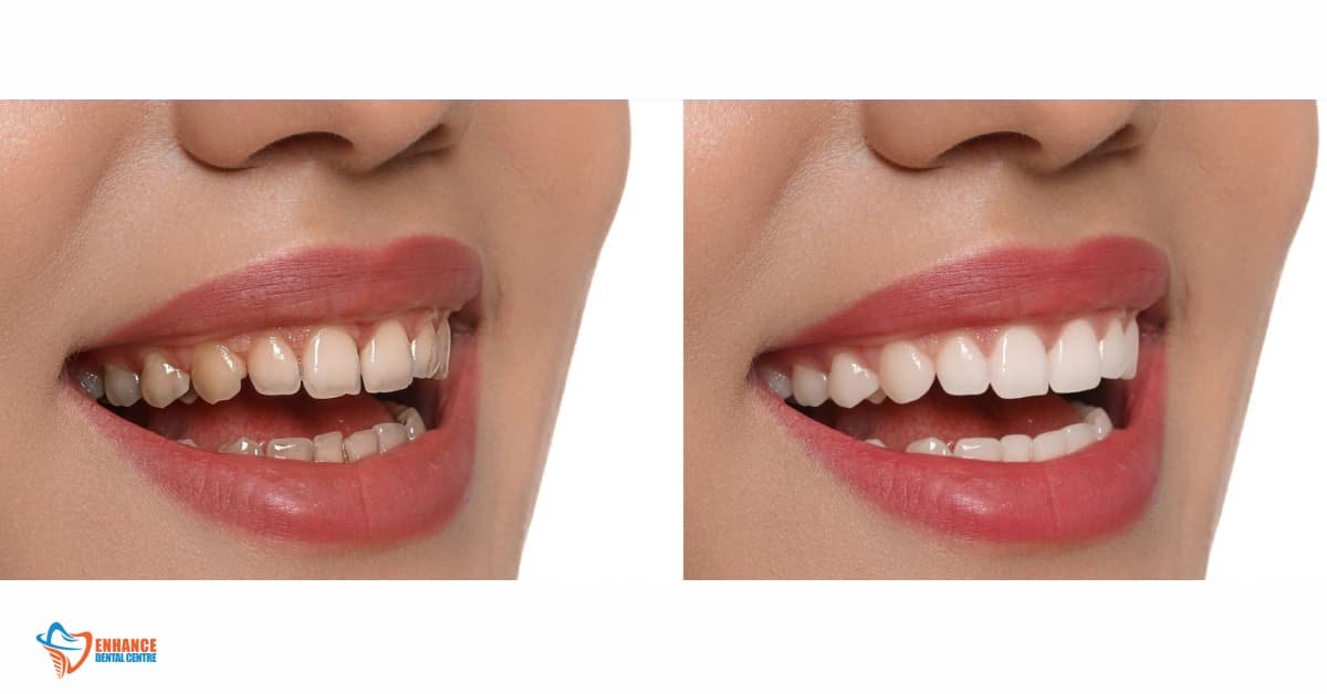 Real Patient Transformations (Before and After Photos)