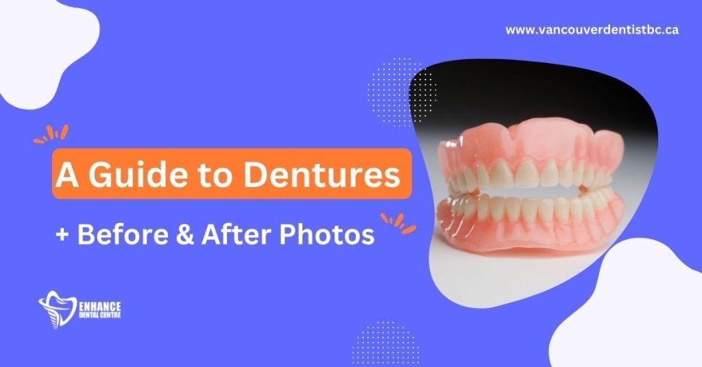 A Guide to Dentures + Before & After Photos