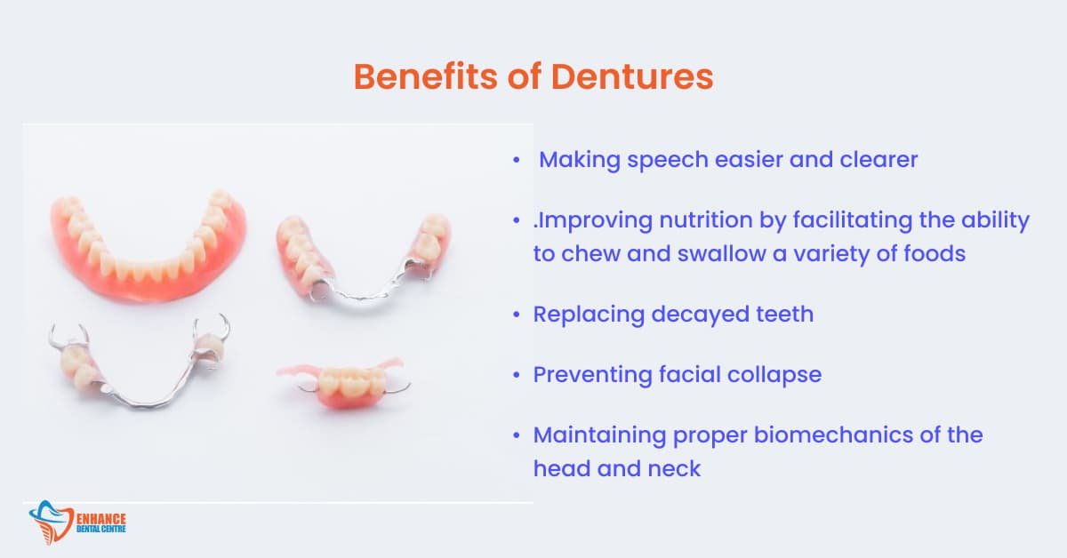 Benefits of Dentures