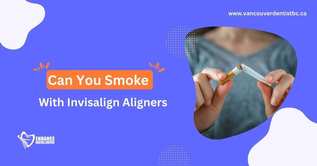 Can You Smoke With Invisalign Aligners?