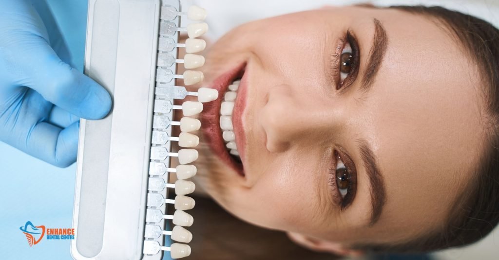 Difference between Invisalign and Veneers