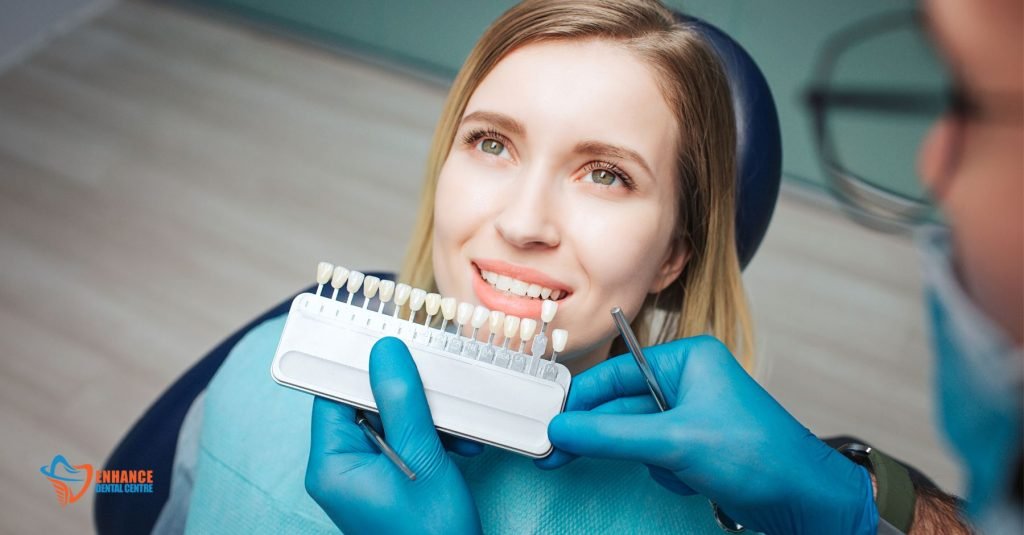 Everything You Need to Know About Veneers