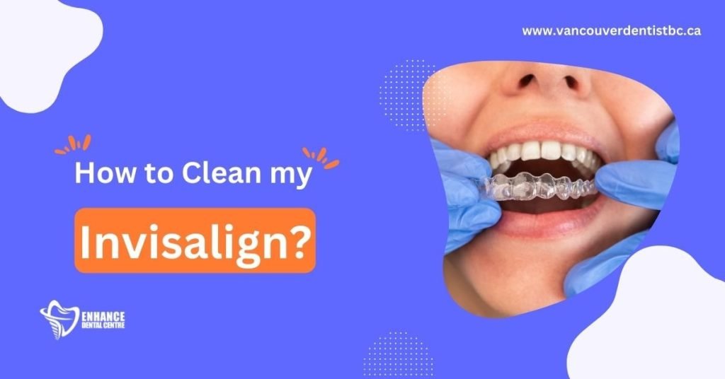 How to Clean my Invisalign?