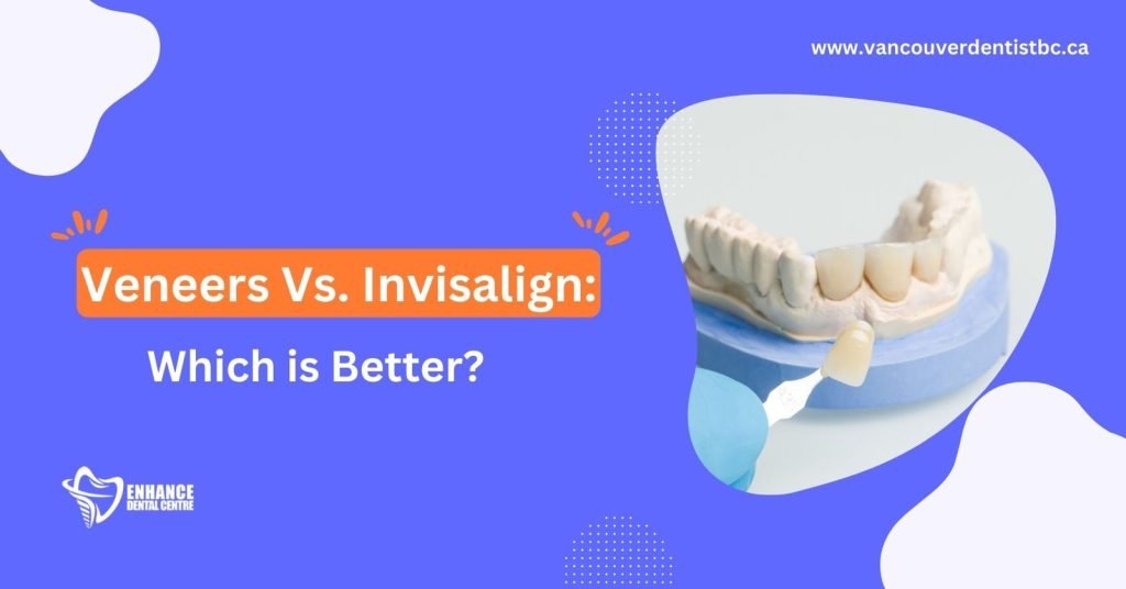 Veneers Vs. Invisalign: Which is Better?