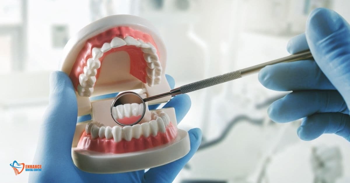 Who is a Candidate for Implant-Supported Dentures?