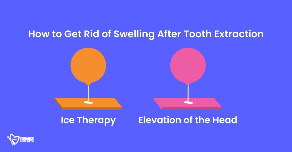 How to Get Rid of Swelling After Tooth Extraction