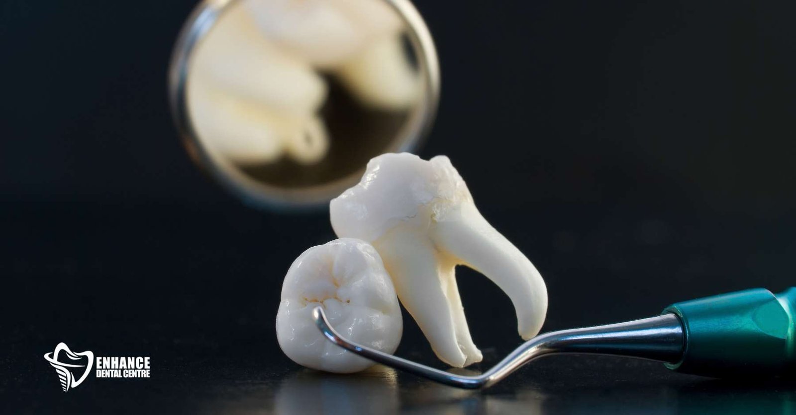 The Dos and Don'ts of Tooth Extraction 