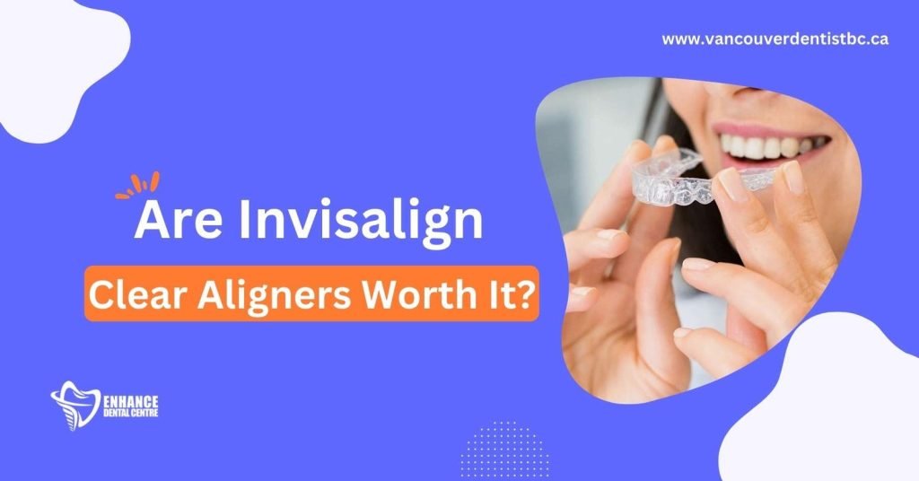 Are Invisalign Clear Aligners Worth It