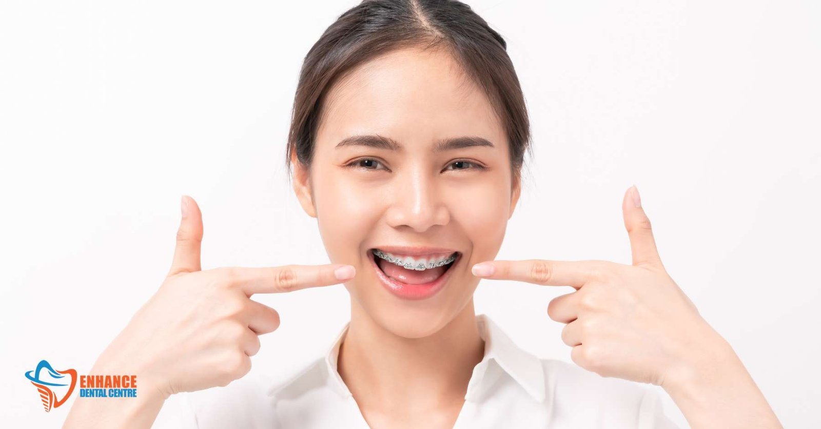 Is Invisalign Better than Braces?