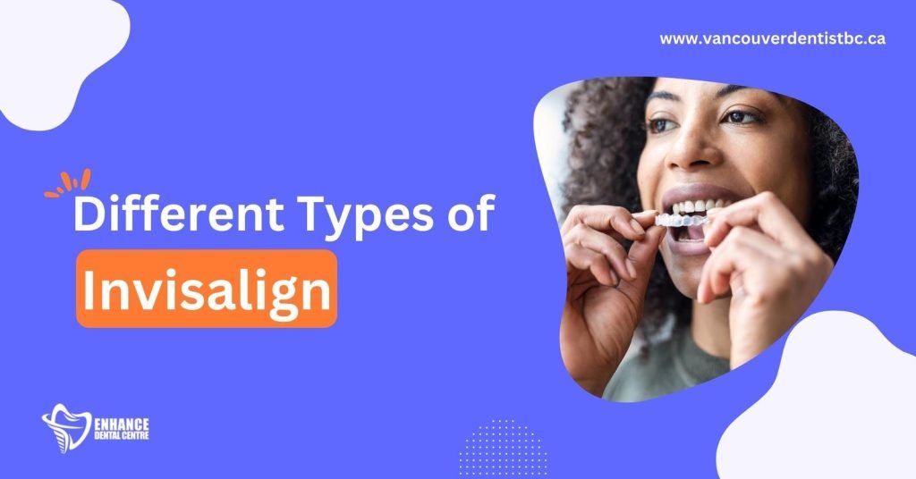 Different Types of Invisalign