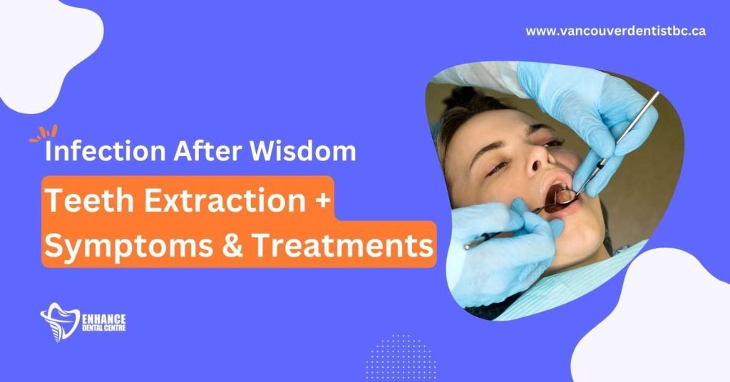 Infection After Wisdom Teeth Extraction