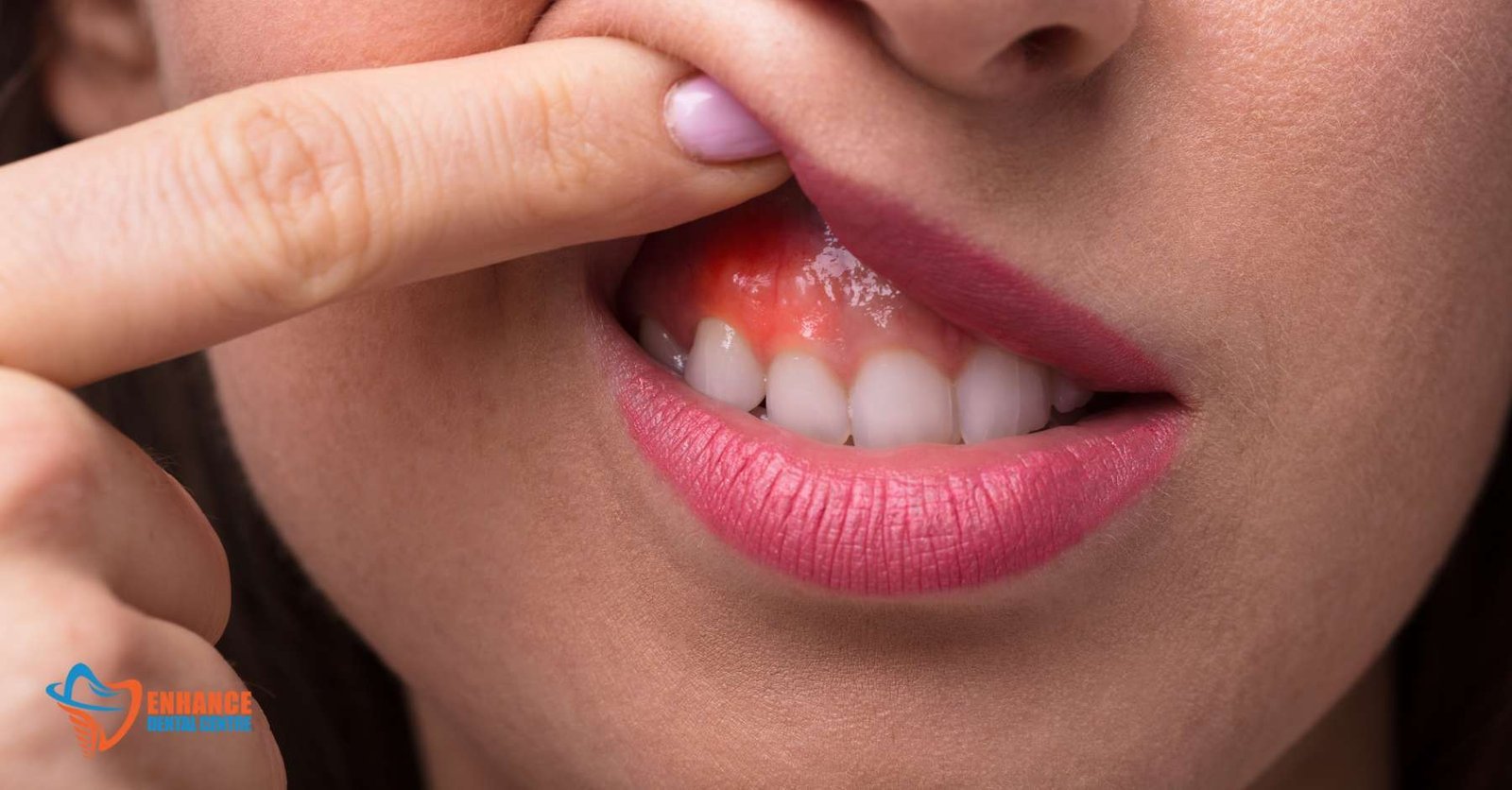 Manage Pain and Swelling