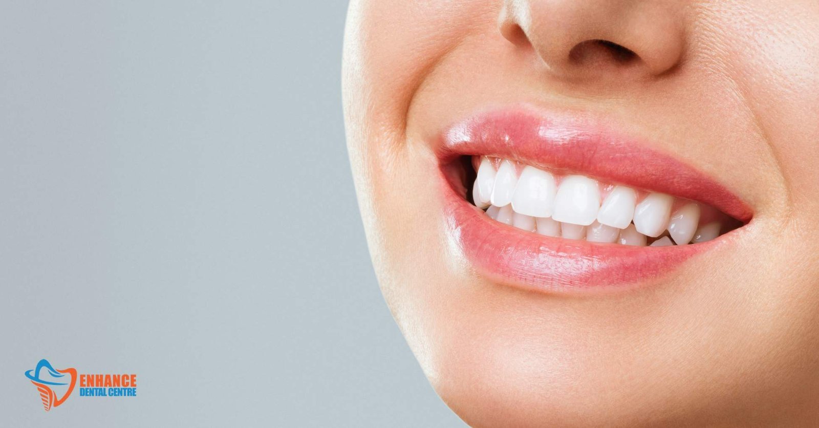 Crowded Teeth
