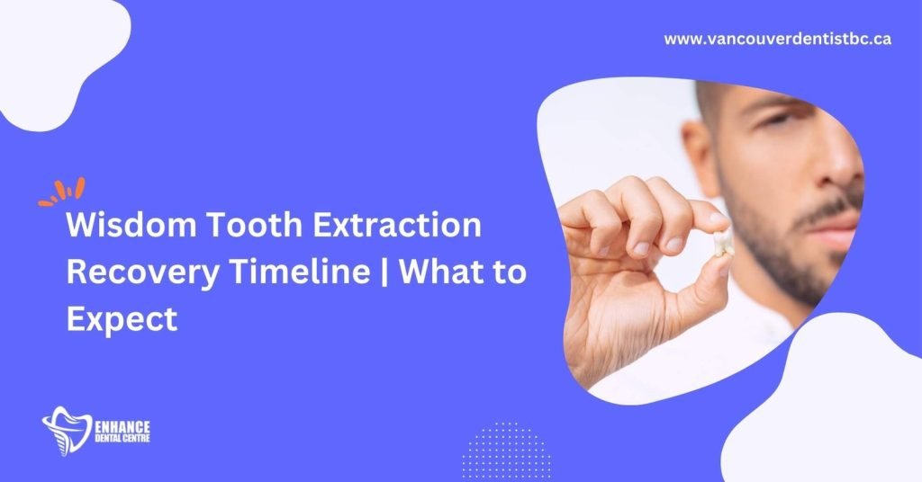 Wisdom Tooth Extraction Recovery Timeline