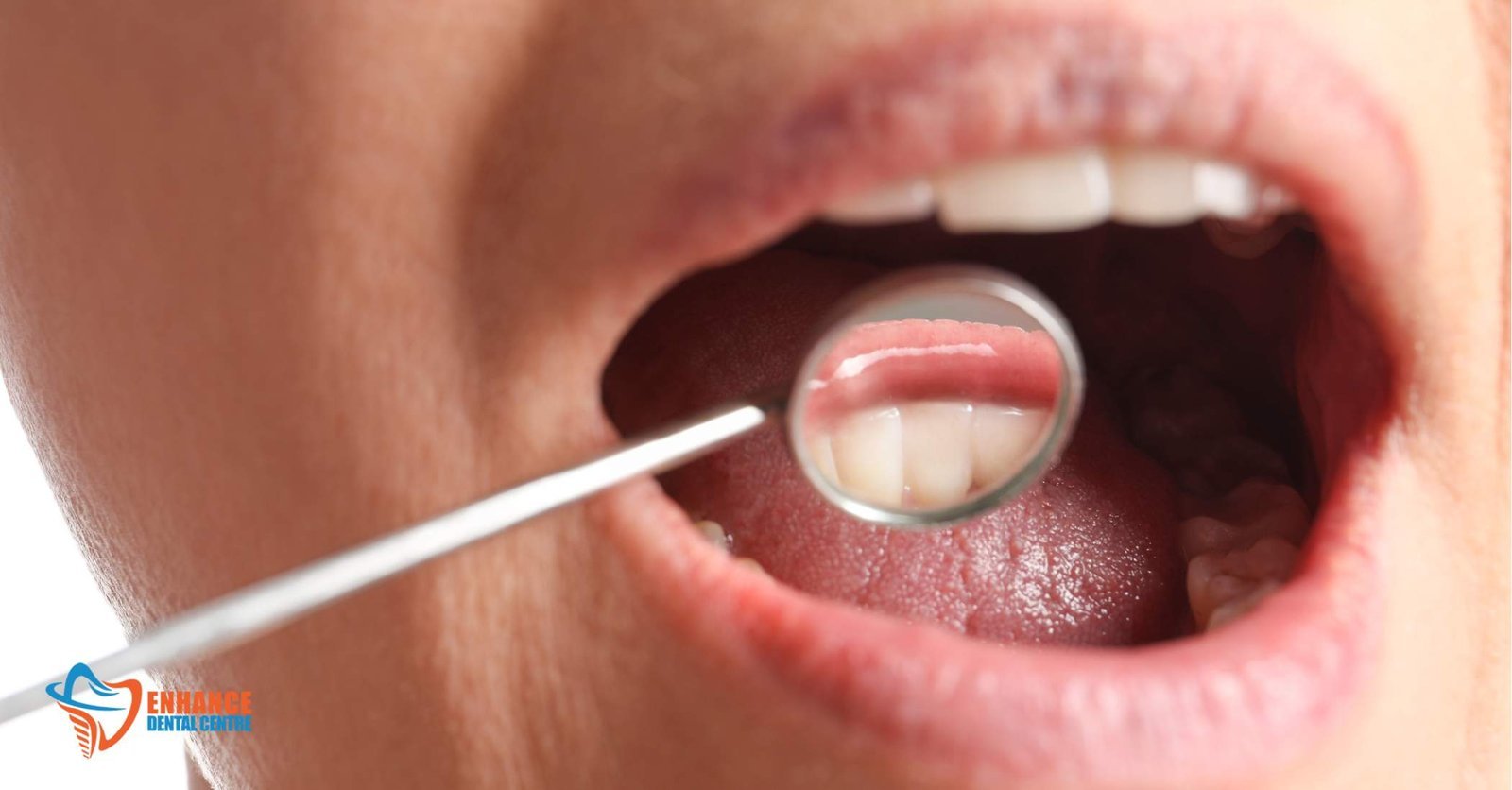 Crown Lengthening Dental Procedure