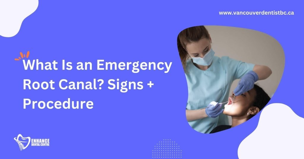 What Is an Emergency Root Canal