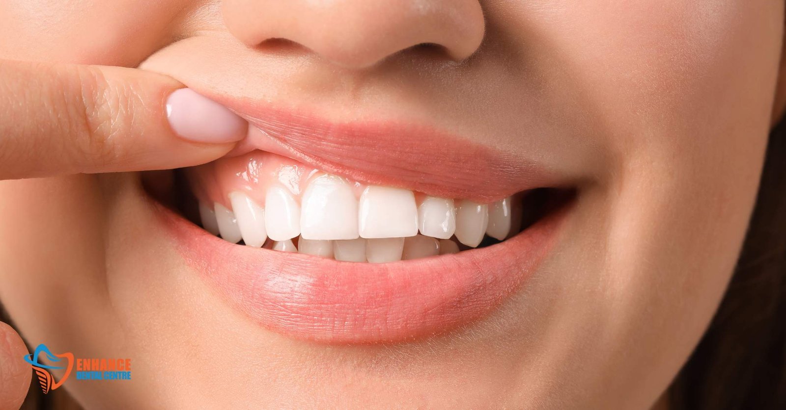Key Nutrients Essential for Strong Teeth and Gums