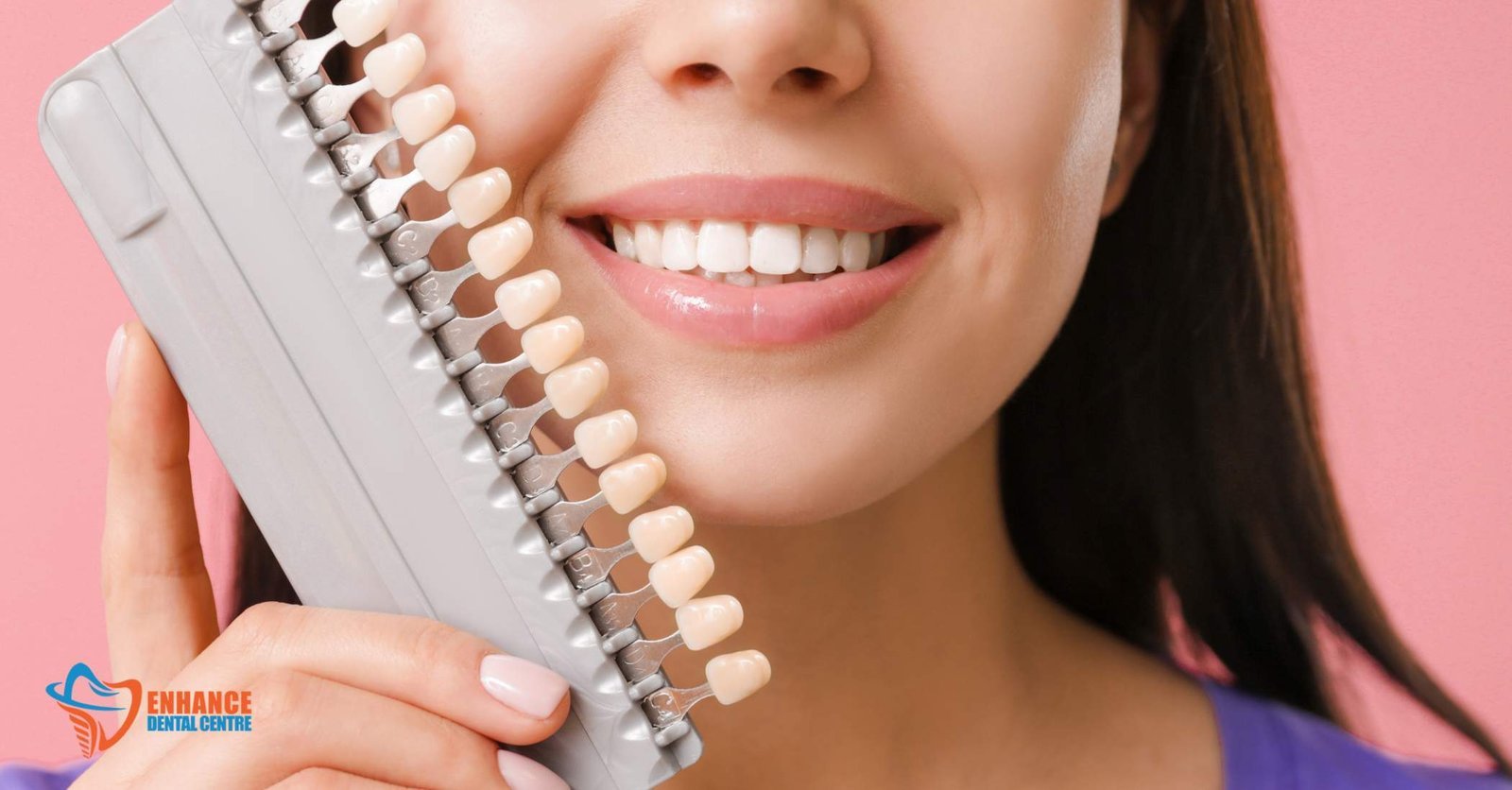 Cost comparison between full smile makeovers with multiple veneers