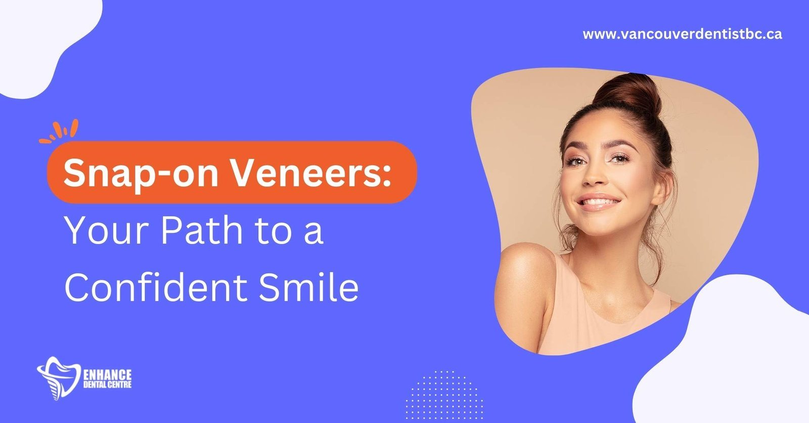 All About Snap-on Veneers: Full guide