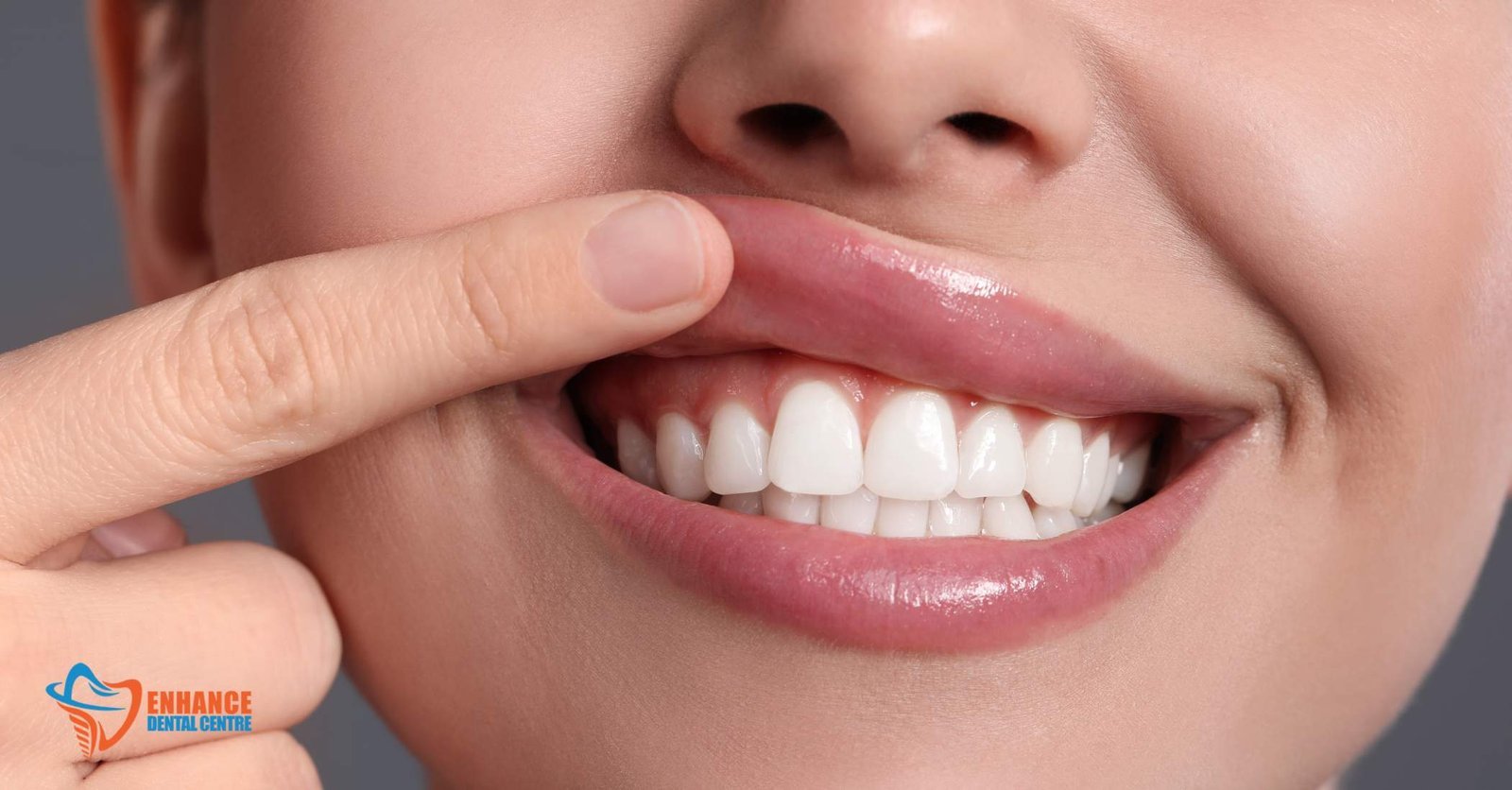 Gum Contouring