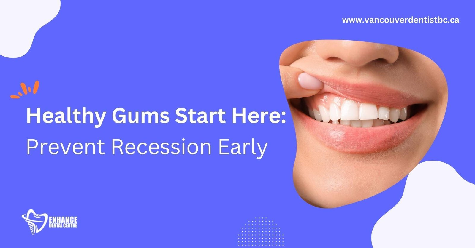 How to Prevent Gum Recession