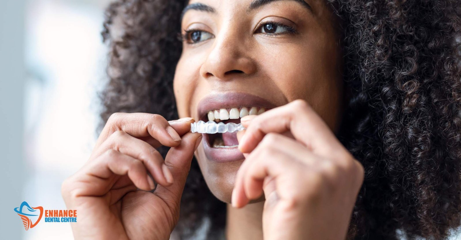 Invisible braces (clear aligners)