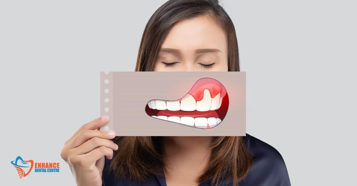 periodontal disease progression