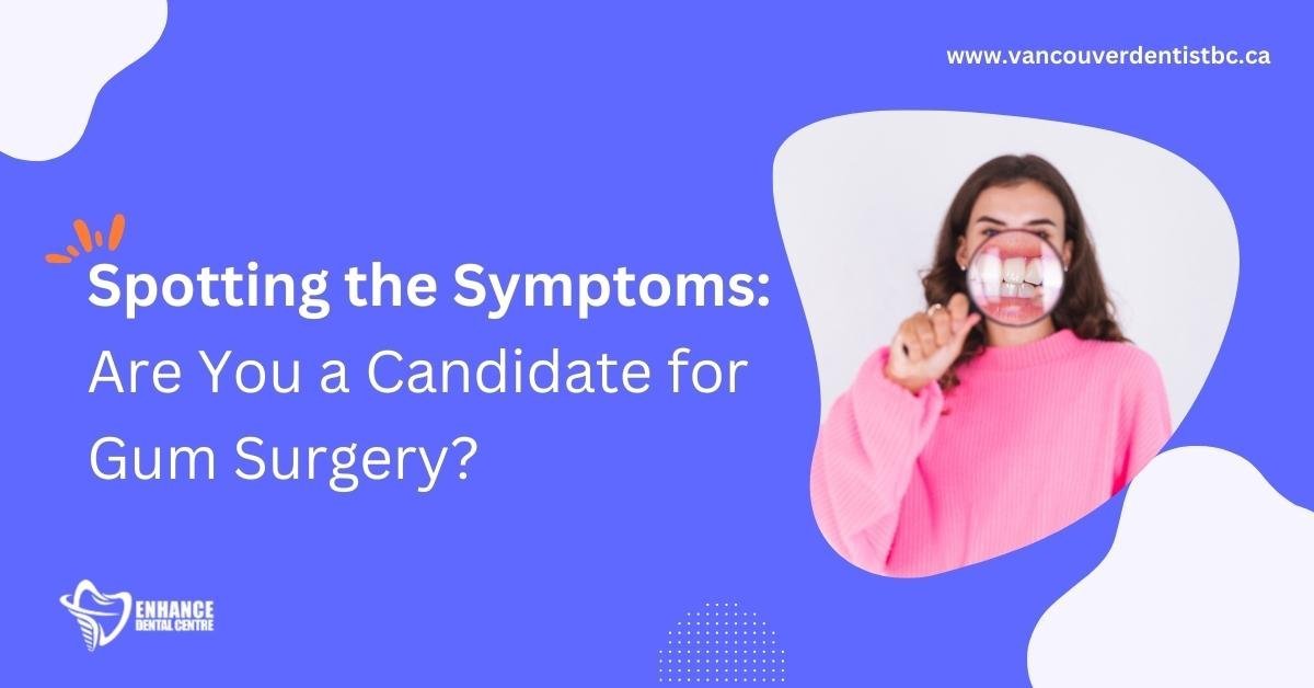 Warning Signs You May Need Periodontal Surgery