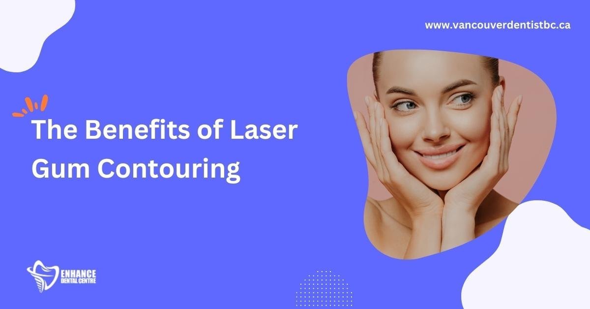 Laser Gum Reshaping