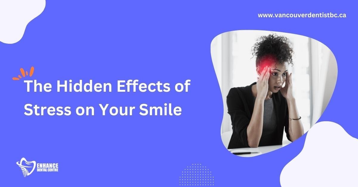 The Connection Between Stress and Dental Health