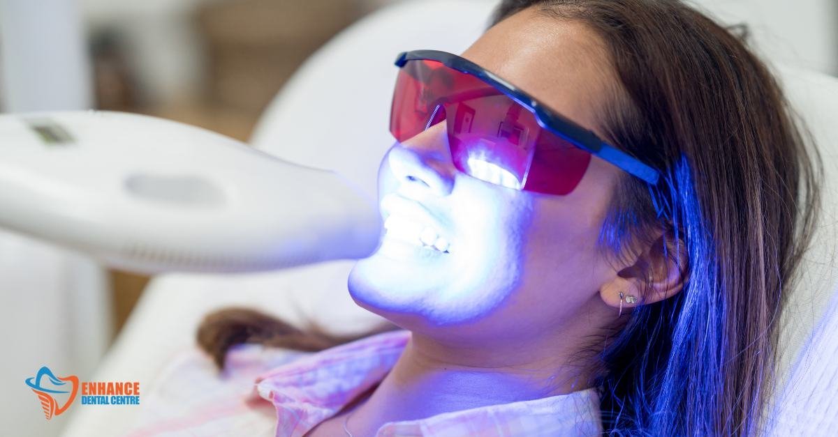 A collection of over-the-counter teeth whitening products