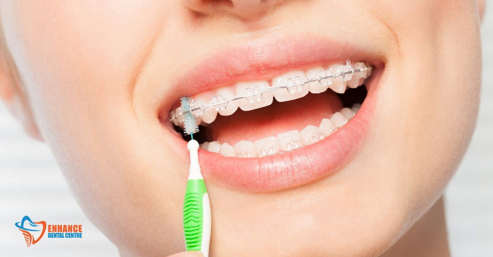 Items for managing braces discomfort