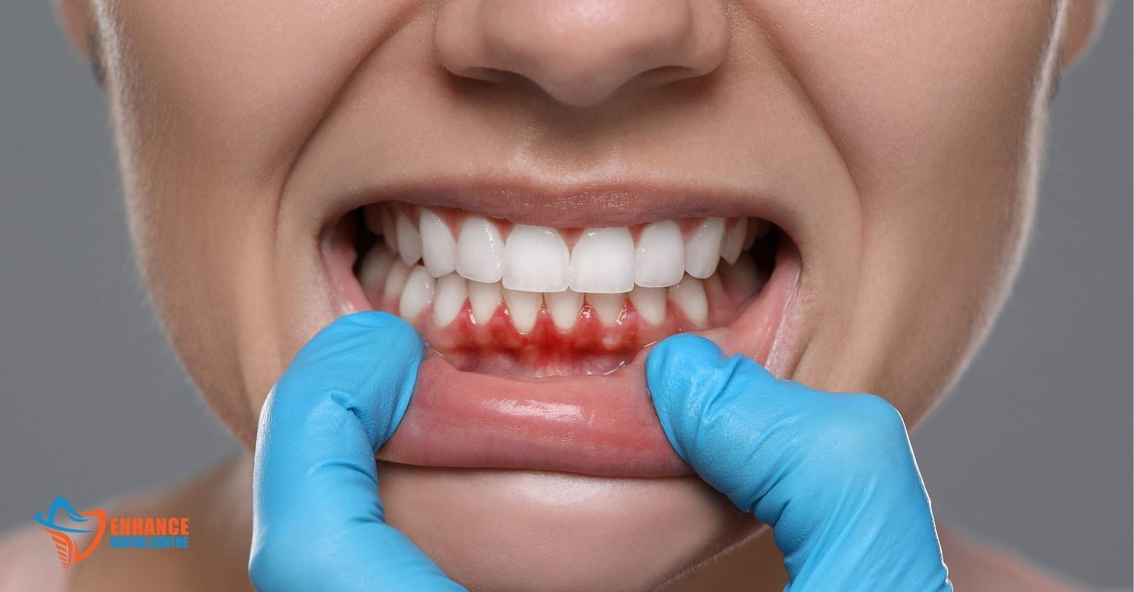 a person experiencing gum pain