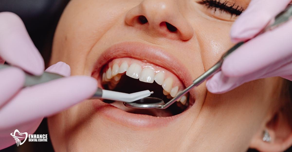 Laser gum reshaping procedure