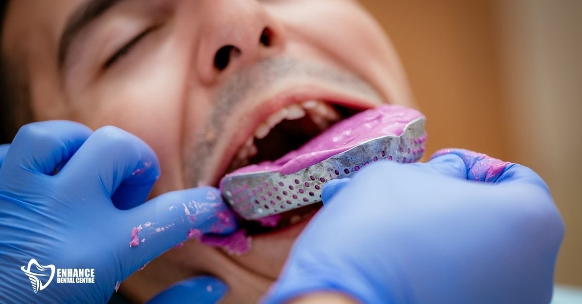 A dentist taking an impression of a patient's teeth
