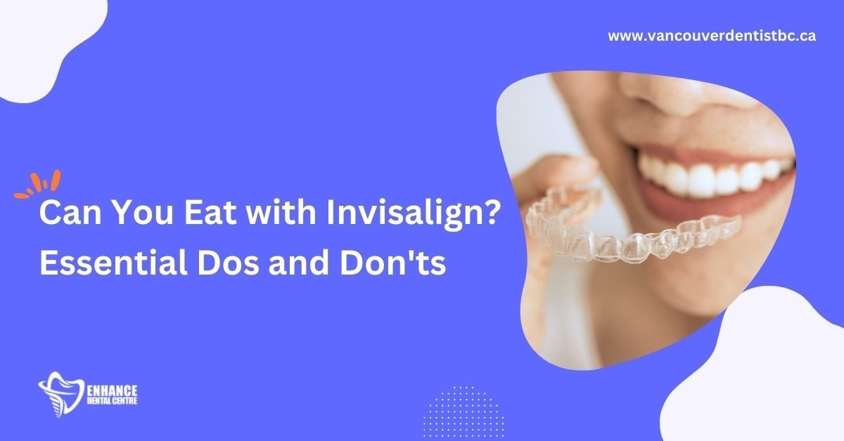 Can You Eat with Invisalign? Important Care Guidelines