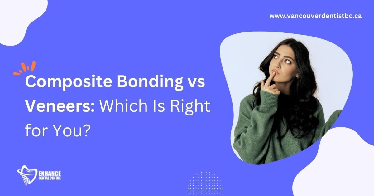 Veneers vs Composite Bonding: Cosmetic Dentistry Compared