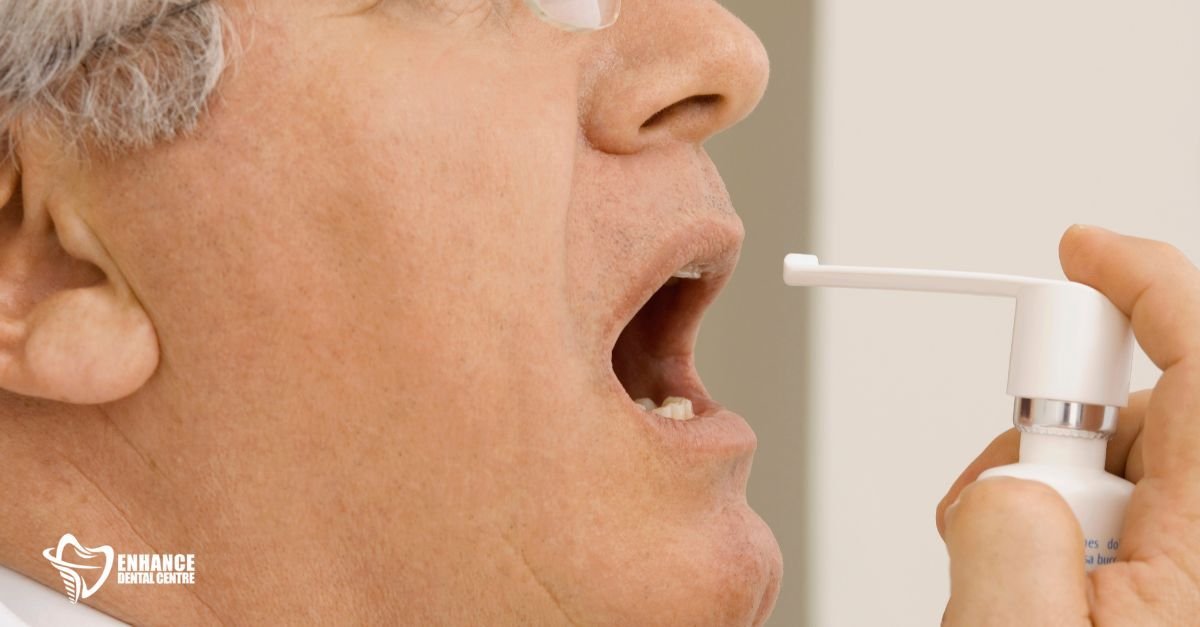 Over-the-counter sprays for managing Sjögren’s Syndrome
