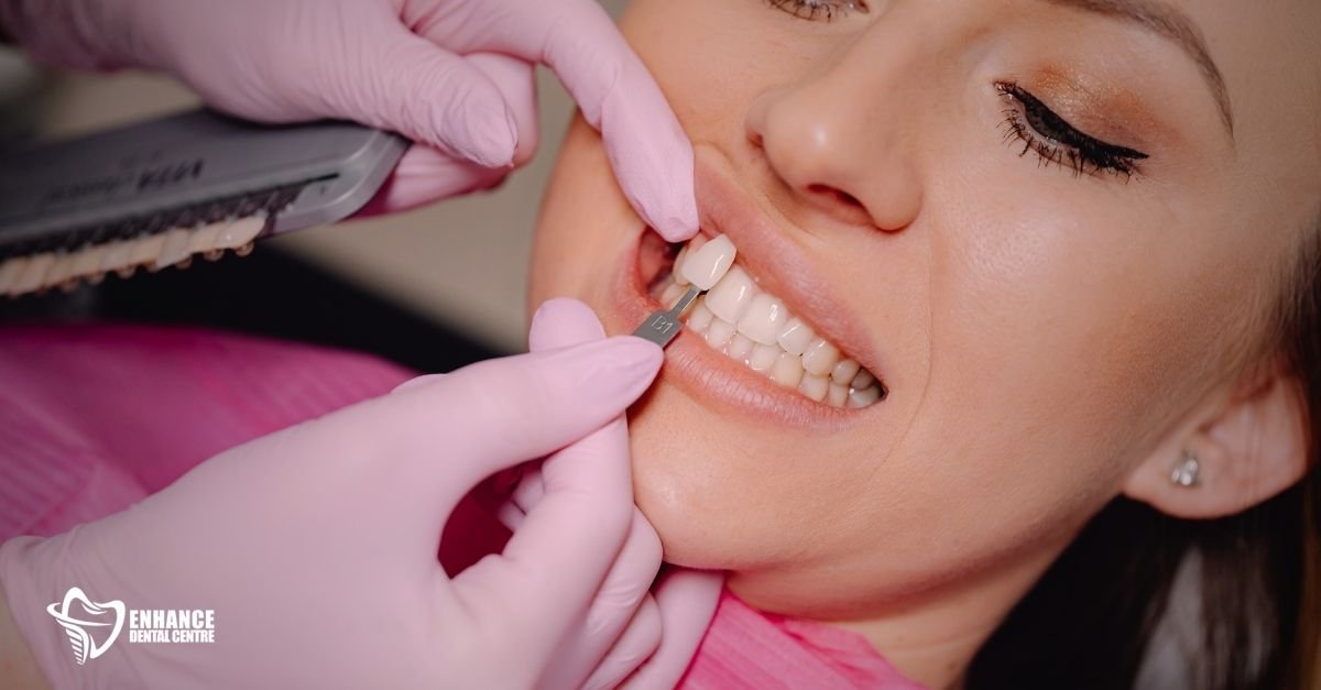 A dentist placing a porcelain veneer on a patient's tooth