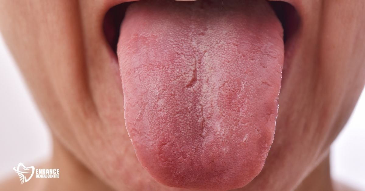 Elderly person experiencing dry mouth