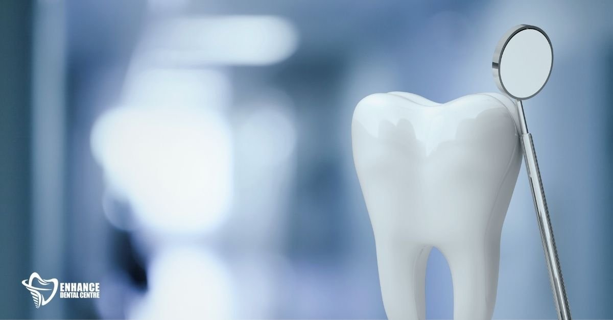 The comparison between composite bonding and veneers