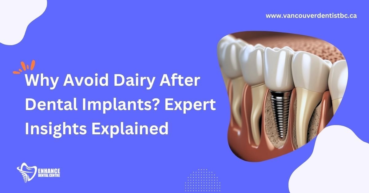 Should You Avoid Dairy After Dental Implant Surgery