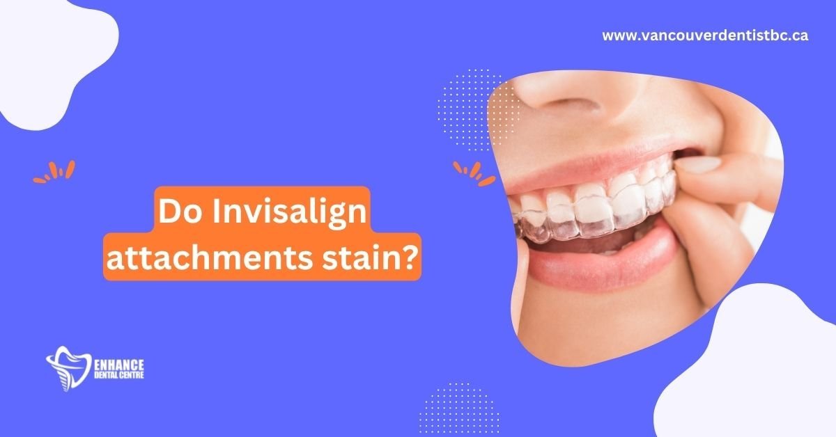 Do Invisalign attachments stain