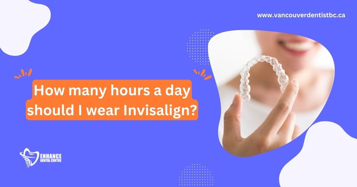 How many hours a day should I wear Invisalign